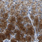Anti-KLK15 Antibody