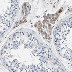 Immunohistochemical staining of human testis shows weak cytoplasmic positivity in Leydig cells.