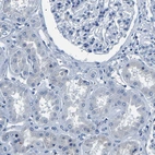 Immunohistochemical staining of human kidney shows no positivity in cells in tubules or glomeruli.