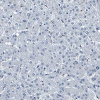 Immunohistochemical staining of human liver shows no positivity in hepatocytes as expected.