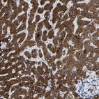 Anti-CCDC171 Antibody