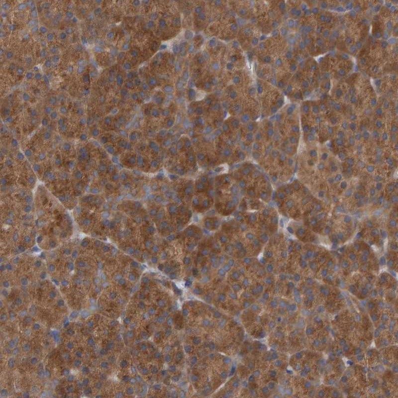 Anti-UBAP1 Antibody