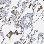 Immunohistochemical staining of human lung shows moderate cytoplasmic positivity in macrophages.