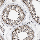 Immunohistochemical staining of human testis shows weak to moderate cytoplasmic positivity in cells in seminiferous ducts.