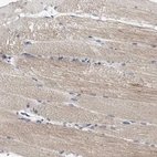 Immunohistochemical staining of human skeletal muscle shows weak cytoplasmic positivity in myocytes.