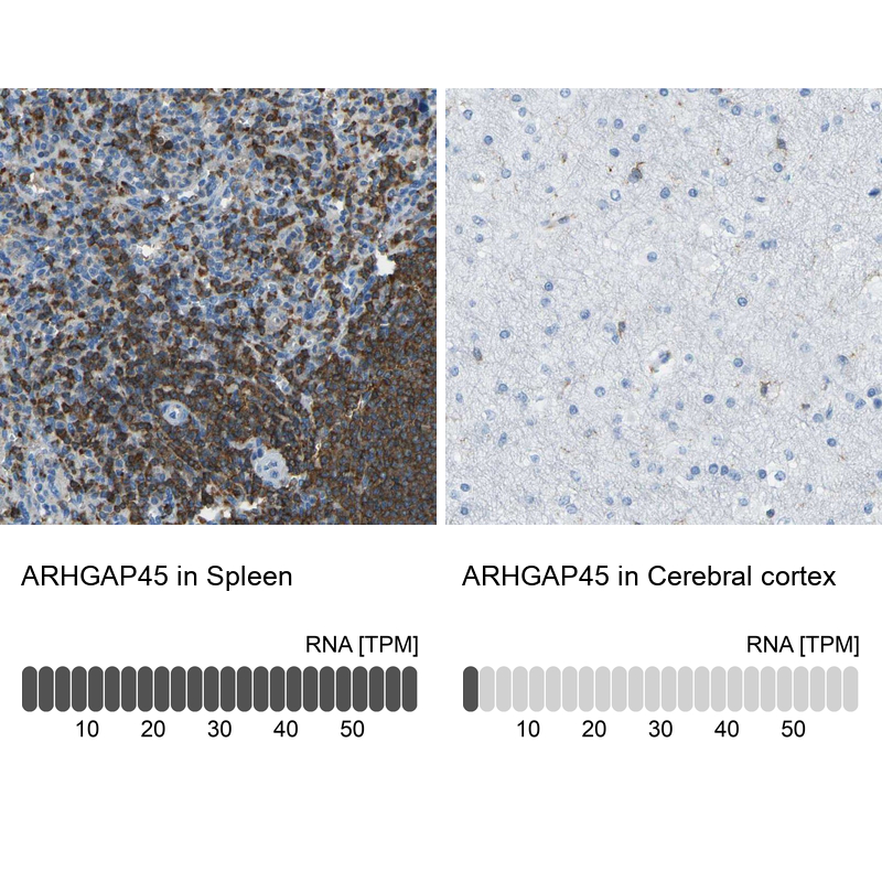 Anti-ARHGAP45 Antibody