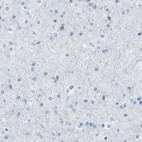 Immunohistochemical staining of human cerebral cortex shows low expression as expected.
