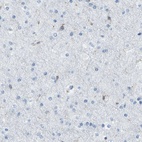 Anti-ARHGAP45 Antibody