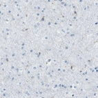 Immunohistochemical staining of human cerebral cortex shows low expression as expected.