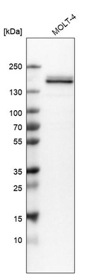Western blot analysis in human cell line MOLT-4.