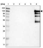Lane 1: Marker [kDa] 230, 130, 95, 72, 56, 36, 28, 17, 11_br/_Lane 2: Human cell line RT-4_br/_Lane 3: Human cell line U-251MG sp_br/_Lane 4: Human plasma (IgG/HSA depleted)_br/_Lane 5: Human liver tissue_br/_Lane 6: Human tonsil tissue