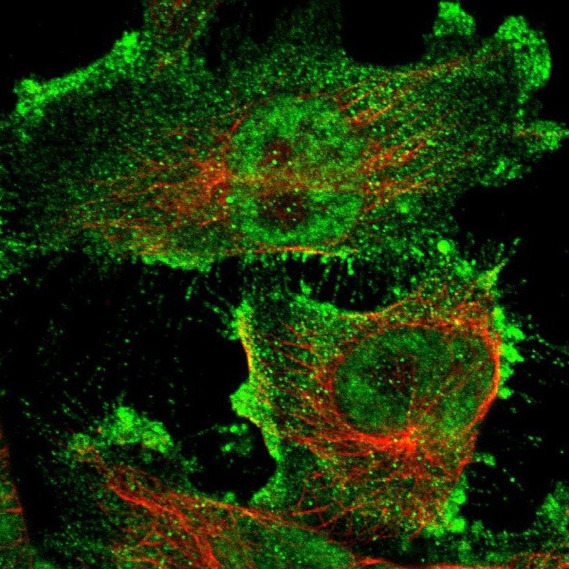 Anti-ARHGAP23 Antibody