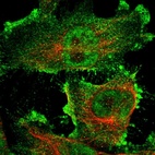 Anti-ARHGAP23 Antibody