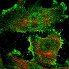 Anti-ARHGAP23 Antibody