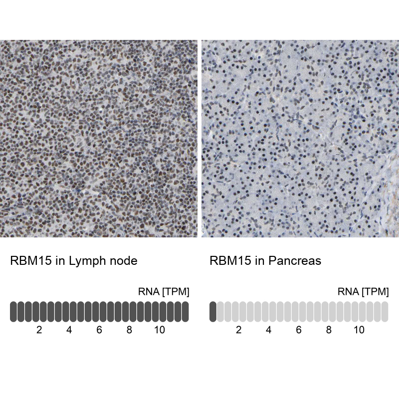 Anti-RBM15 Antibody
