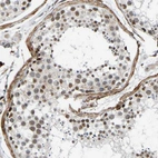 Immunohistochemical staining of human testis shows moderate nuclear positivity in cells in seminiferous ducts.