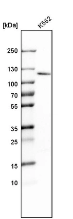 Western blot analysis in human cell line K562.