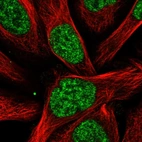 Immunofluorescent staining of human cell line U-2 OS shows localization to nucleoplasm.