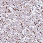 Anti-MRM2 Antibody