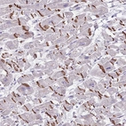 Anti-MRM2 Antibody