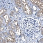 Immunohistochemical staining of human kidney shows moderate cytoplasmic positivity in cells in tubules.
