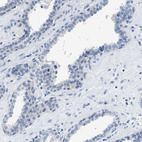 Anti-NUDT5 Antibody