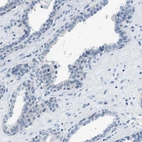 Immunohistochemical staining of human prostate shows no positivity in glandular cells.