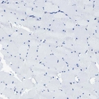 Immunohistochemical staining of human skeletal muscle shows no positivity in myocytes.
