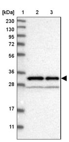 Lane 1: Marker [kDa] 230, 130, 95, 72, 56, 36, 28, 17, 11_br/_Lane 2: Human cell line RT-4_br/_Lane 3: Human cell line U-251MG sp