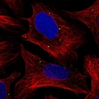 Immunofluorescent staining of human cell line U-2 OS shows localization to vesicles.