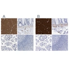 Immunohistochemical staining of human cerebral cortex, colon, placenta and tonsil using Anti-AMPH antibody HPA019828 (A) shows similar protein distribution across tissues to independent antibody HPA019829 (B).