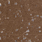 Immunohistochemical staining of human cerebral cortex shows strong cytoplasmic positivity in neuropil.