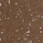 Immunohistochemical staining of human cerebral cortex shows strong cytoplasmic positivity in neuropil.