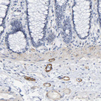 Immunohistochemical staining of human colon shows strong cytoplasmic positivity in peripheral nerve / ganglion.