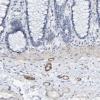 Immunohistochemical staining of human colon shows strong cytoplasmic positivity in peripheral nerve / ganglion.