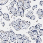 Immunohistochemical staining of human placenta shows no positivity in trophoblastic cells as expected.