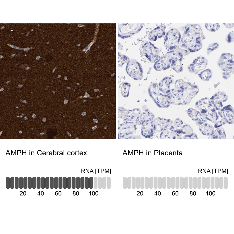 Anti-AMPH Antibody