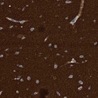 Immunohistochemical staining of human cerebral cortex shows strong cytoplasmic positivity in neuropil.