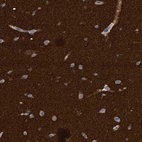 Immunohistochemical staining of human cerebral cortex shows strong cytoplasmic positivity in neuropil.