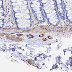 Immunohistochemical staining of human colon shows strong cytoplasmic positivity in peripheral nerve / ganglion.