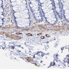 Immunohistochemical staining of human colon shows strong cytoplasmic positivity in peripheral nerve / ganglion.