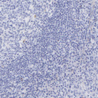 Immunohistochemical staining of human tonsil shows no positivity in non-germinal center cells as expected.