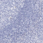 Immunohistochemical staining of human tonsil shows no positivity in non-germinal center cells as expected.