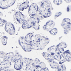 Immunohistochemical staining of human placenta shows no positivity in trophoblastic cells as expected.