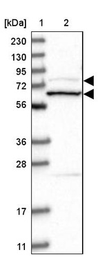 Lane 1: Marker [kDa] 230, 130, 95, 72, 56, 36, 28, 17, 11_br/_Lane 2: Human cell line RT-4