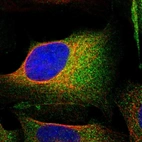 Immunofluorescent staining of human cell line U-2 OS shows localization to cytosol.