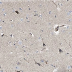 Anti-NAPEPLD Antibody