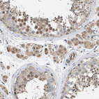 Immunohistochemical staining of human testis shows moderate nuclear positivity in cells in seminiferous ducts.