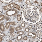 Immunohistochemical staining of human kidney shows moderate cytoplasmic positivity in cells in tubules.