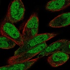Immunofluorescent staining of human cell line RH-30 shows localization to nucleoplasm & cytosol.